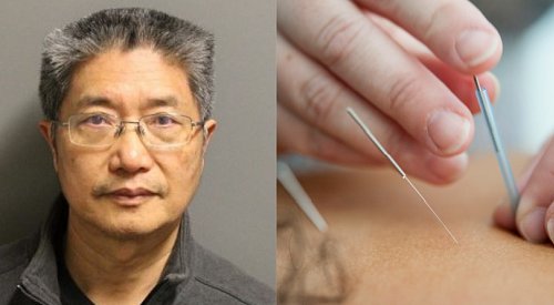 West Kelowna acupuncturist charged with sexual assault